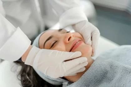 Treatment of facial stains with chemical peeling