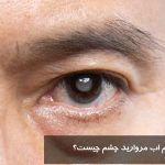 What are the symptoms of pearl water?