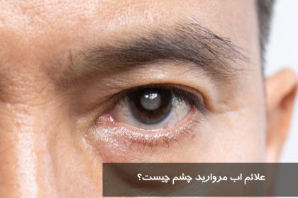 What are the symptoms of pearl water?