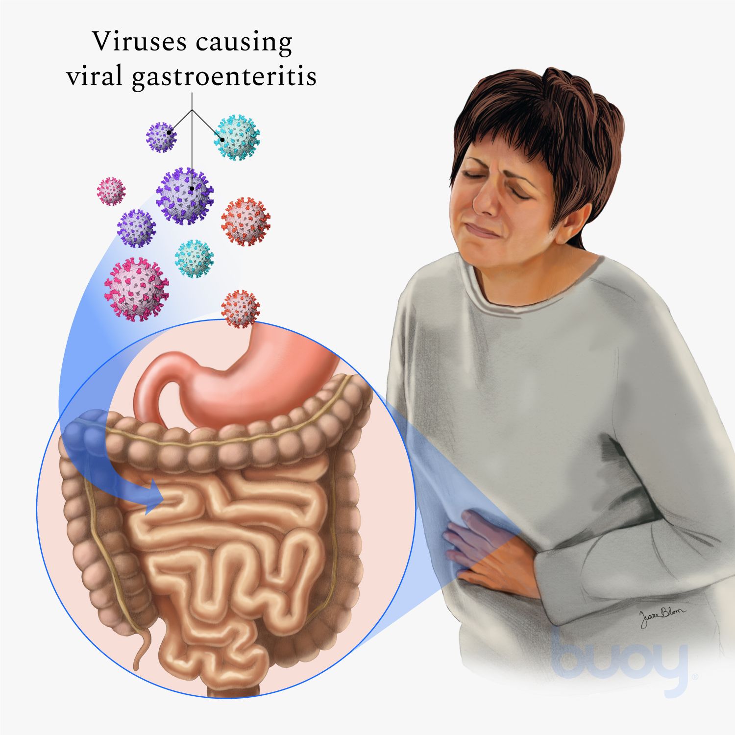 Home treatment of gastrointestinal viruses