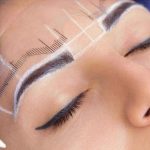 Comparison of eyebrow lift surgery with non -surgical methods