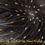 How is the lice egg? What kind and color is it?