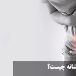 What is a sign of urine burning?