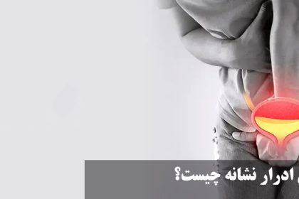 What is a sign of urine burning?