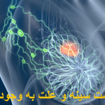 The symptoms of the chest cyst and the cause