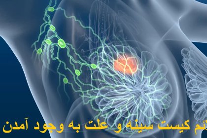 The symptoms of the chest cyst and the cause