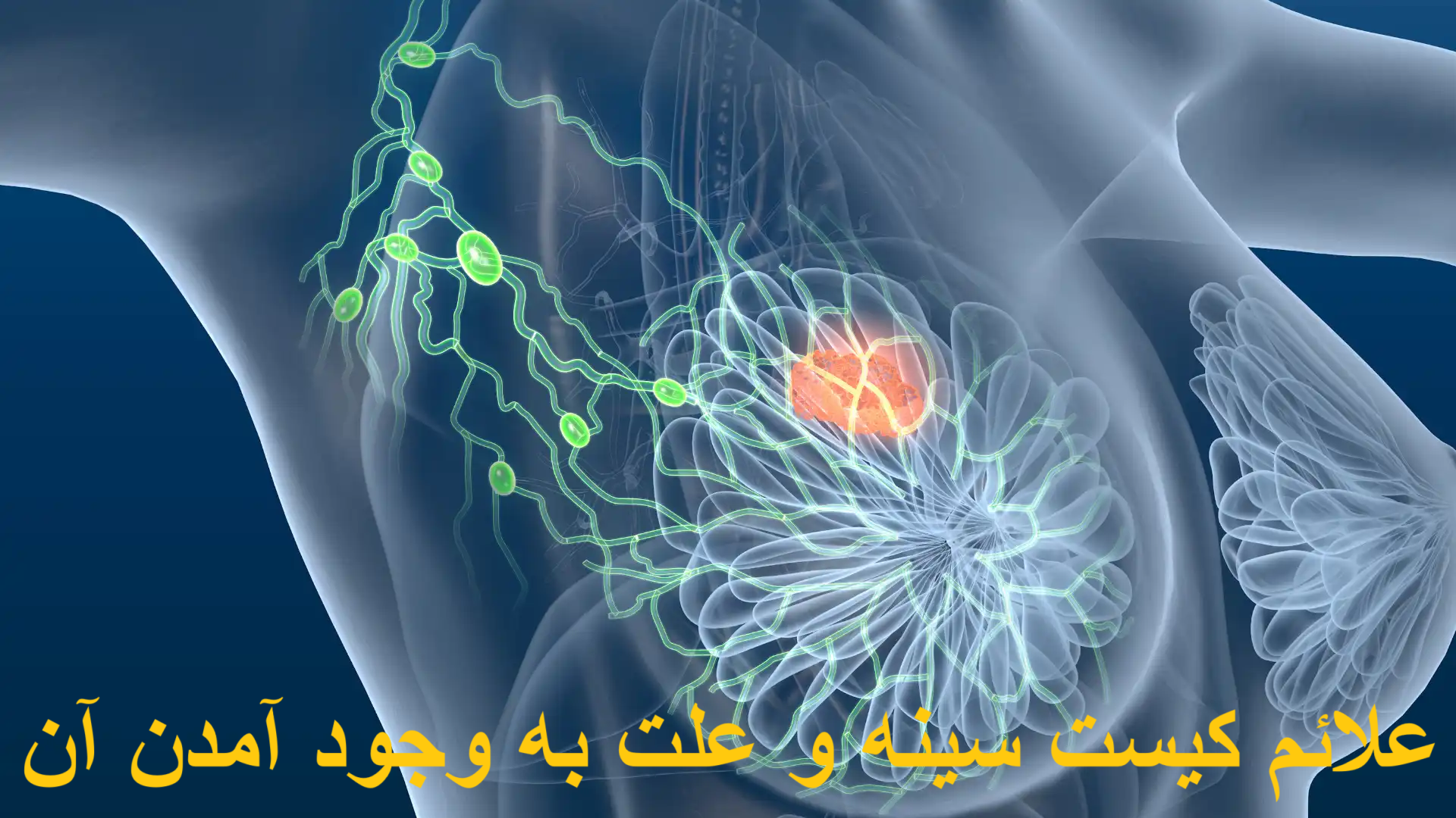 The symptoms of the chest cyst and the cause