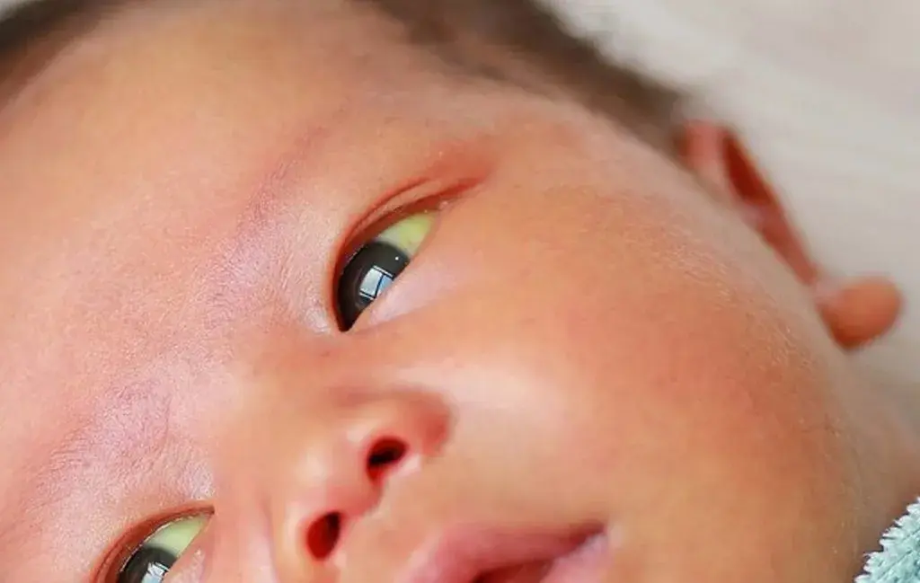 Symptoms of hepatitis B