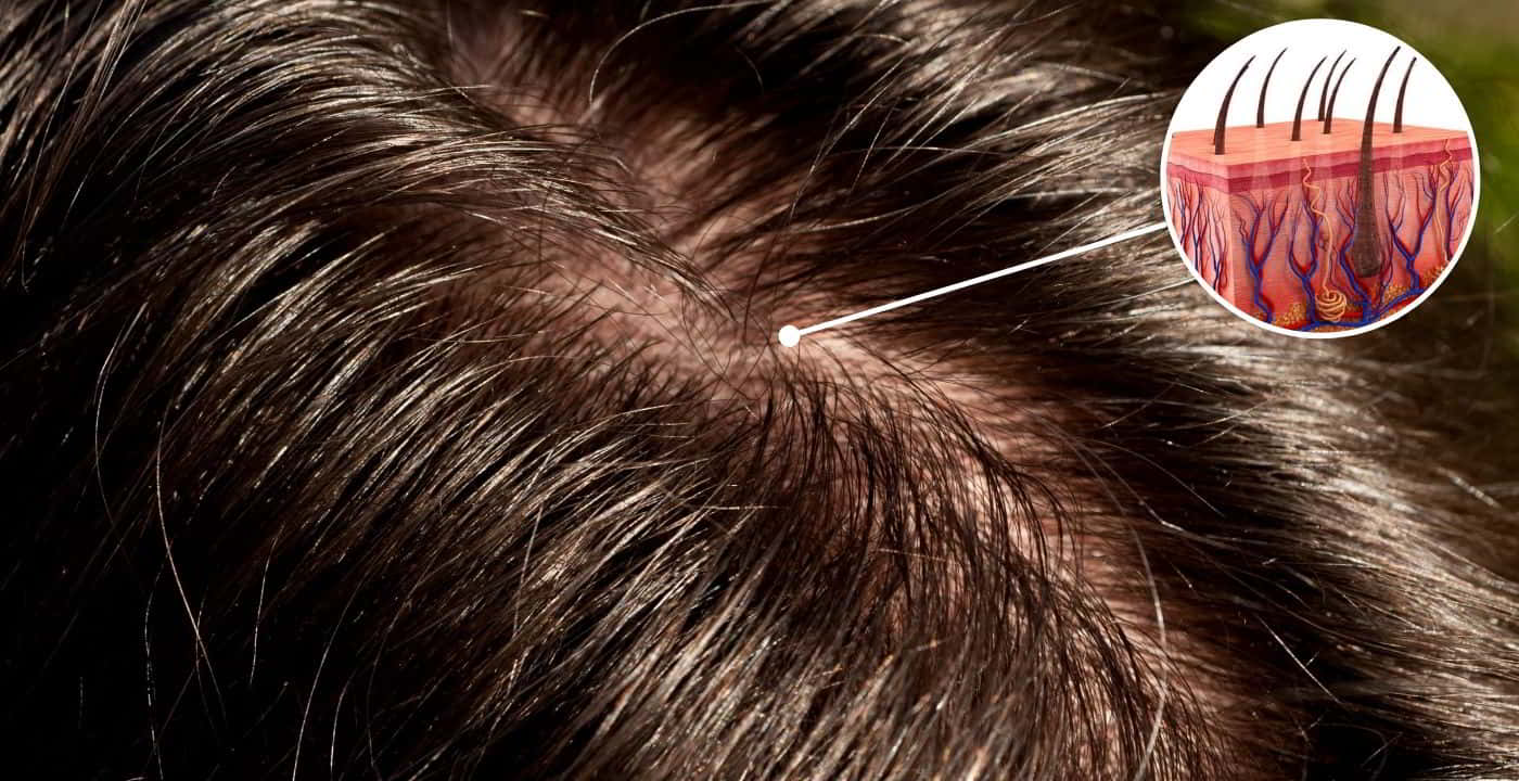 The cause of the greasy hair of men's heads