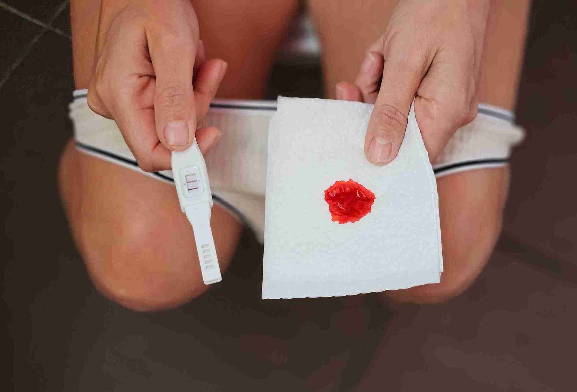 What to eat to stop bleeding during pregnancy?