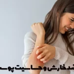 Tablets against itching and skin sensitivity