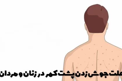 The cause of pimples on the back in women and men