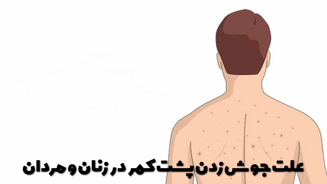 The cause of pimples on the back in women and men
