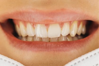 Why are teeth not considered bones? - Diginoy