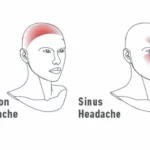 Your pillow is destroying your neck: