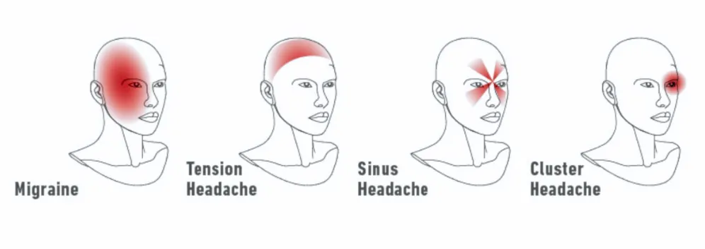 Your pillow is destroying your neck: