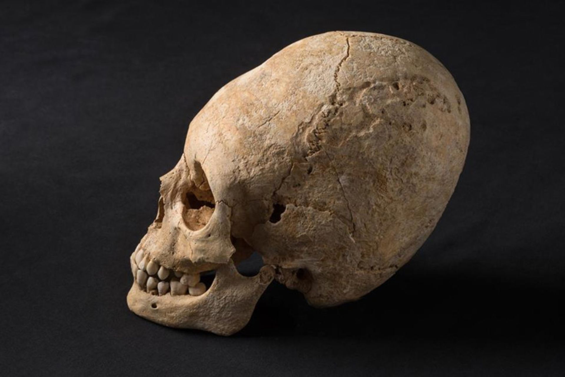 Medieval female skull in Auburn