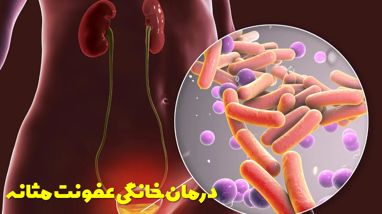Home remedies for bladder infection