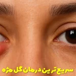 The fastest eyelash treatment