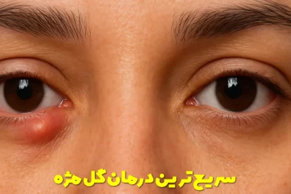 The fastest eyelash treatment