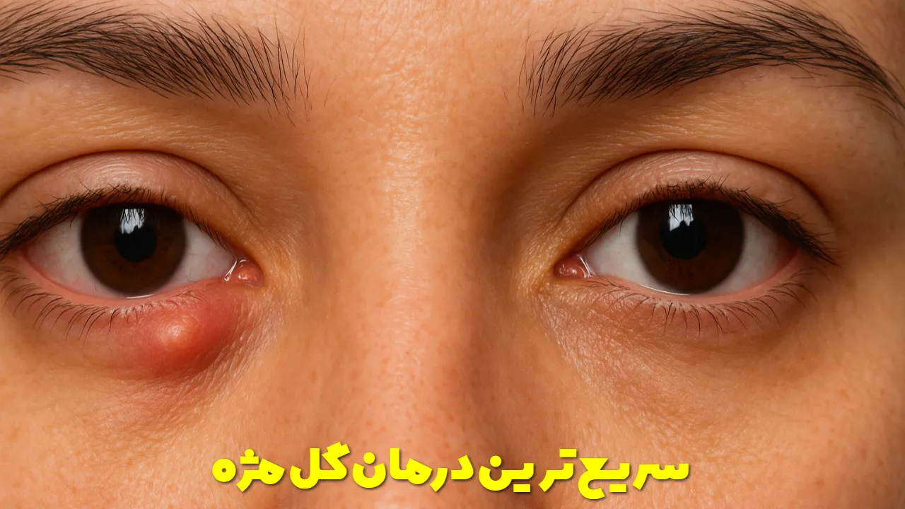 The fastest eyelash treatment