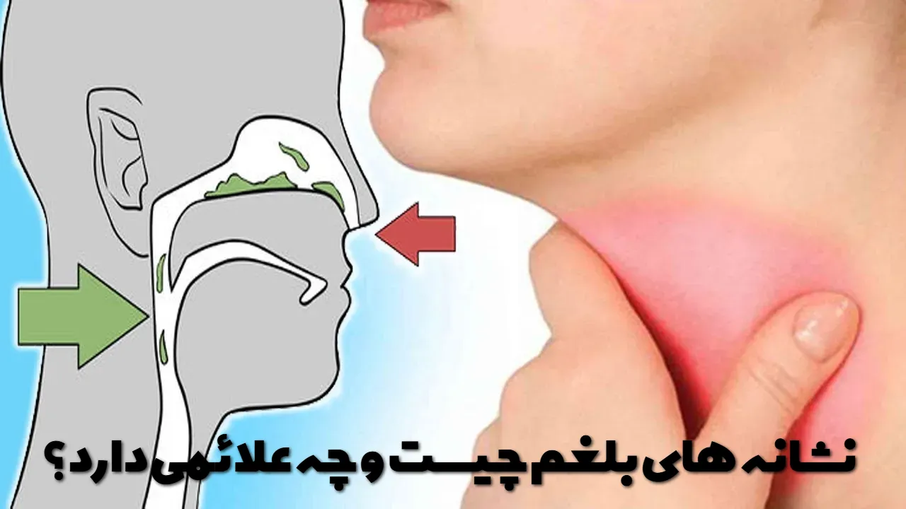 What are the symptoms of phlegm and what are its symptoms?