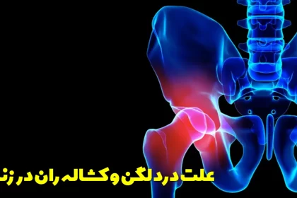 The cause of hip and groin pain in women
