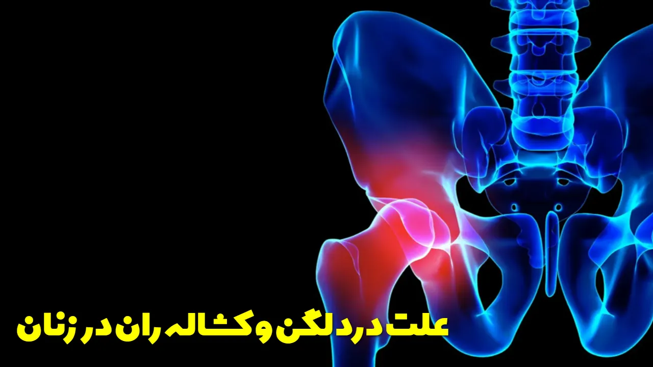 The cause of hip and groin pain in women