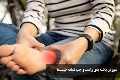 What is the symptom of burning in the heel of the right and left foot?