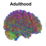 Your Brain Changes at 9, 32, 66, and 83 - Diginoy