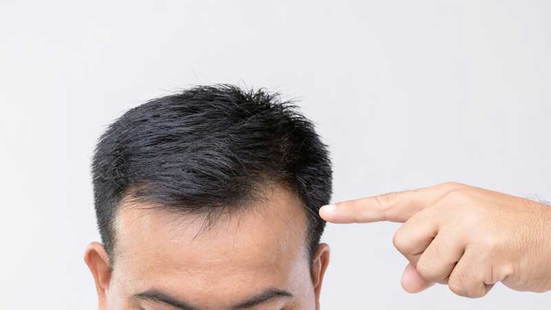 The best hair transplant clinic in Shiraz