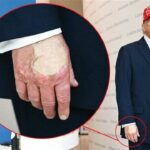 How did the White House justify the bandage on Trump's hand?