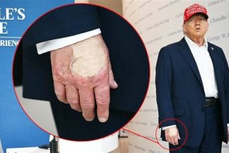 How did the White House justify the bandage on Trump's hand?