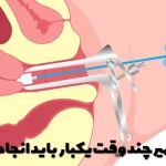 How often should a pap smear be done?