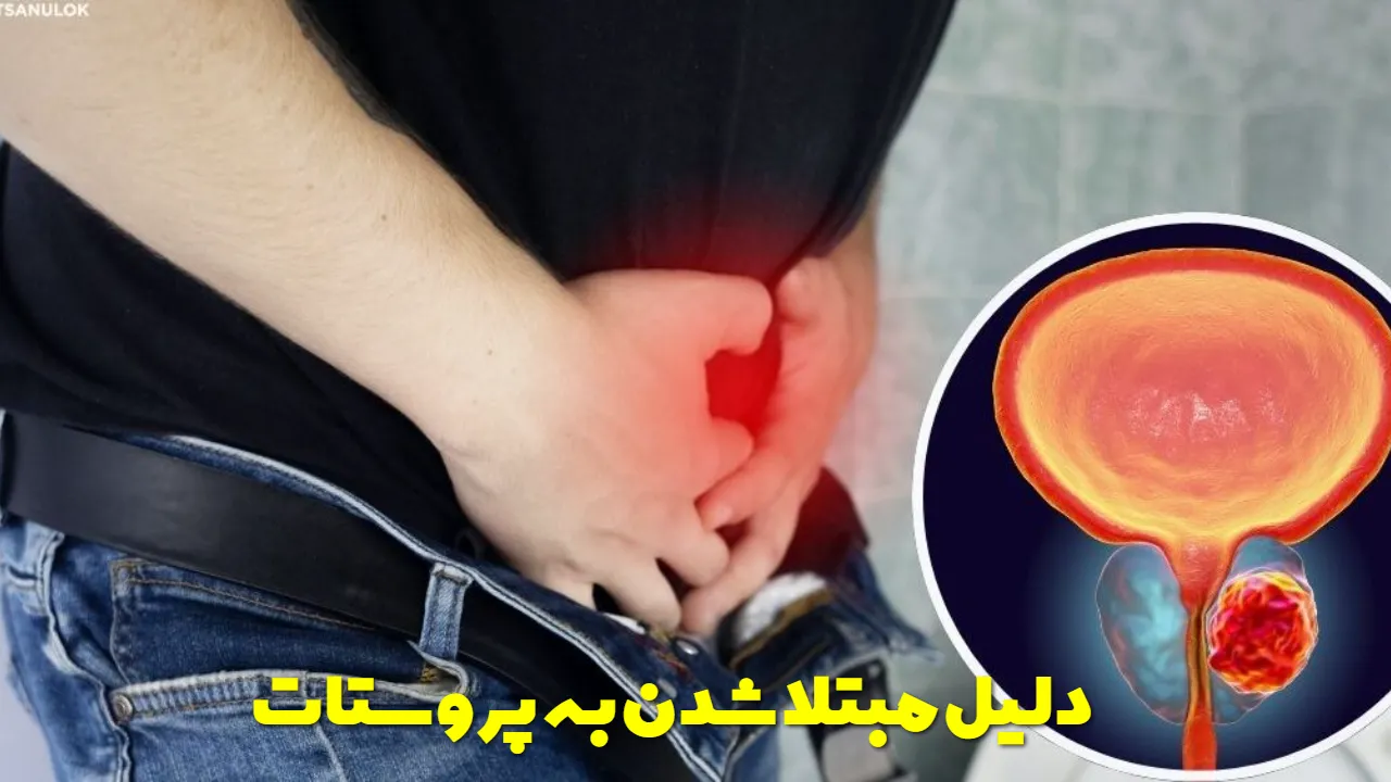 What is the cause of prostate cancer?