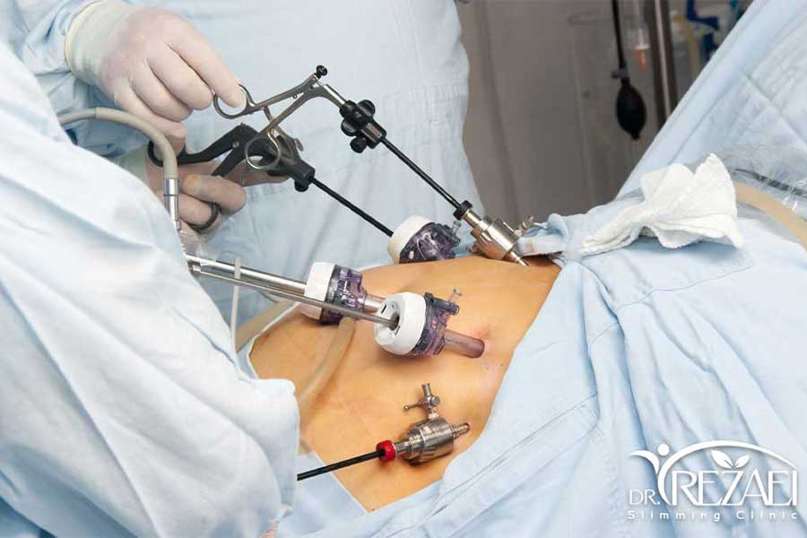 How to perform any bariatric surgery