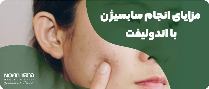 Advantages of endolift subcision