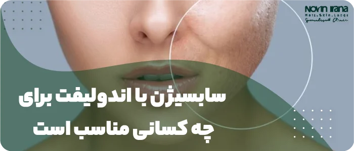 Who is subcision with endolift suitable for?