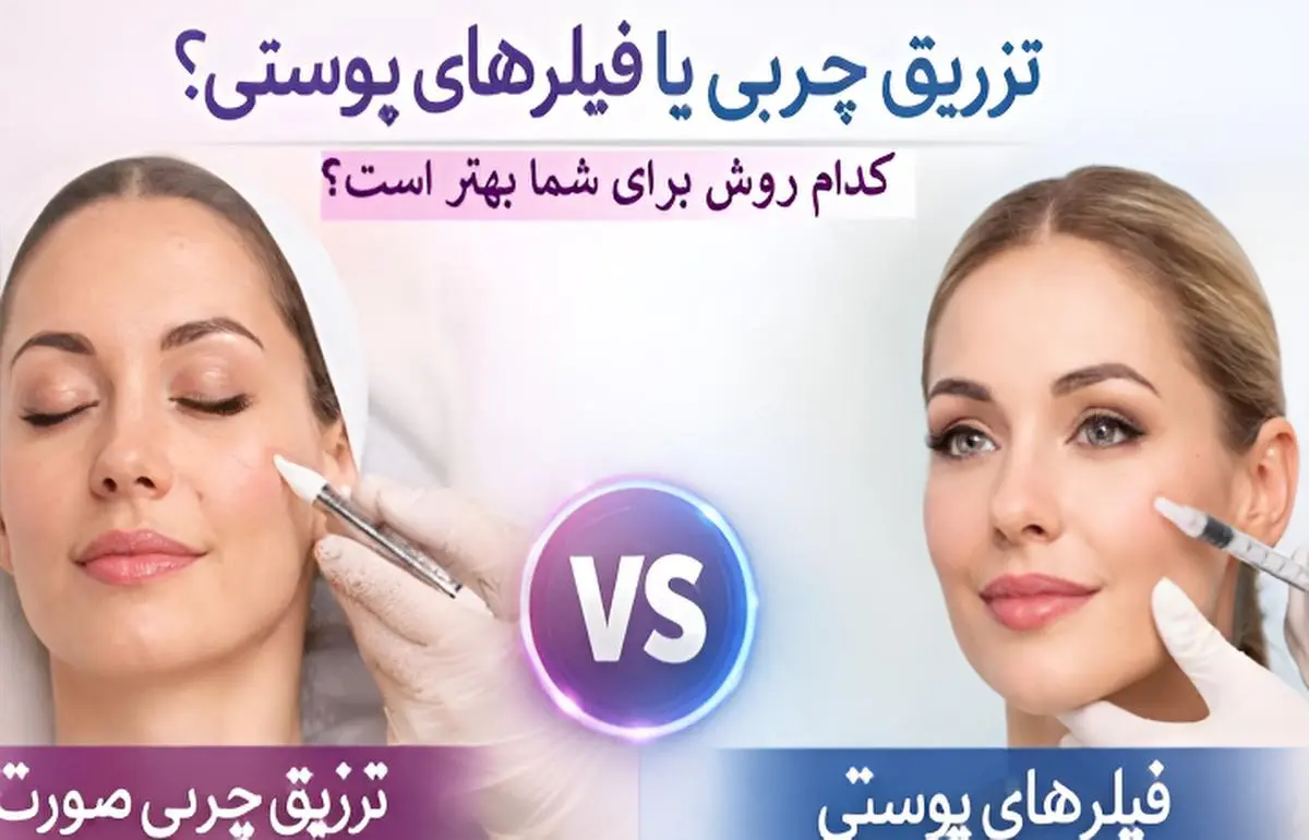 Fat injection or filler injection? Which is better for you?