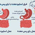 The difference between gastric sleeve and gastric bypass - Dr. Rezaei obesity surgeon