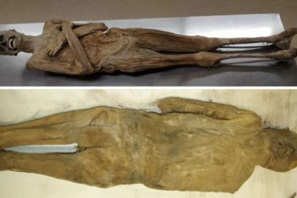 The back and front of the mummy of the Austrian vicar