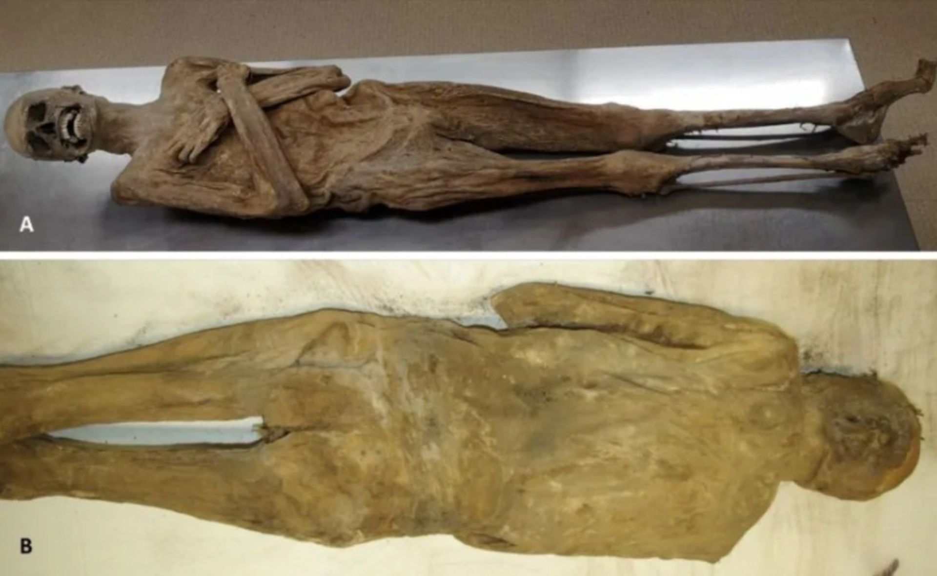 The back and front of the mummy of the Austrian vicar