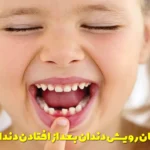 Duration of growth of permanent teeth after the fall of milk teeth