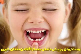 Duration of growth of permanent teeth after the fall of milk teeth