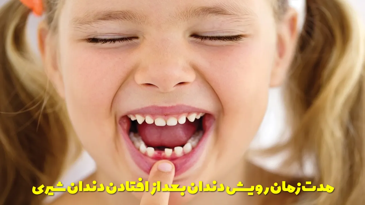 Duration of growth of permanent teeth after the fall of milk teeth