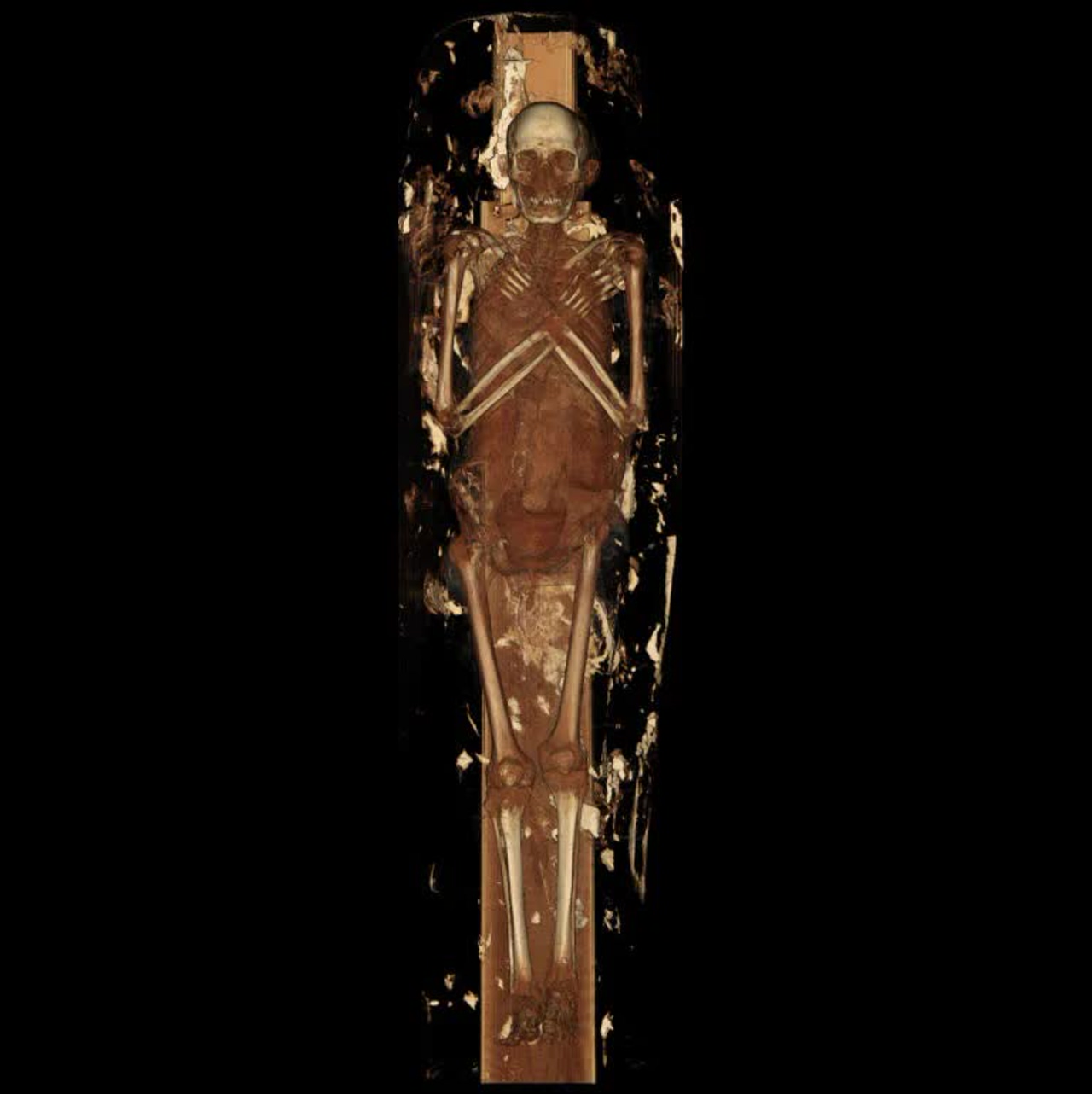 1000023650 Scientists scanned two mummies and came up with some interesting results - diginoy