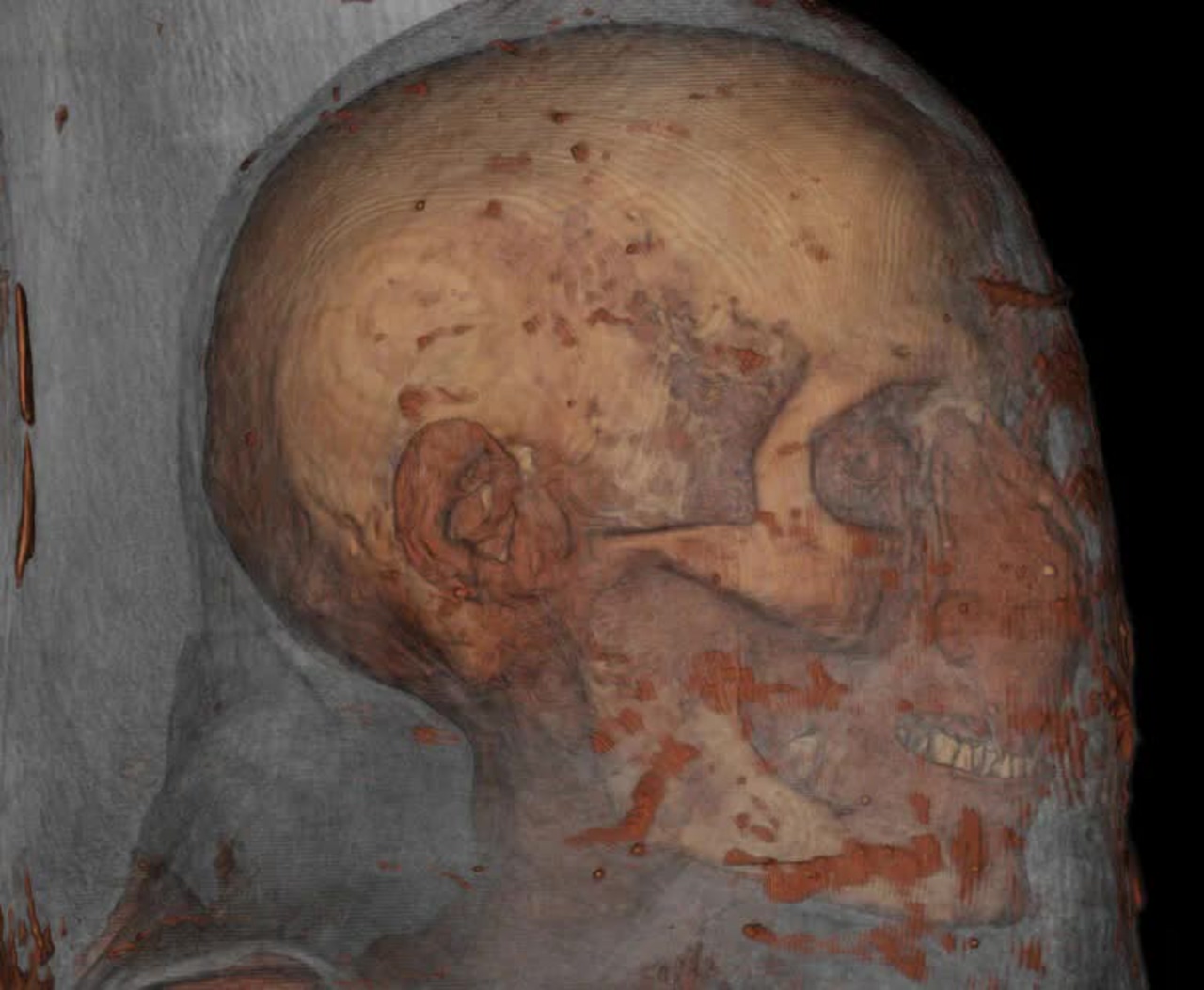 1000023649 Scientists scanned two mummies and came up with some interesting results - diginoy