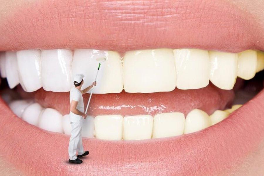 Advantages and disadvantages of laminate compared to composite