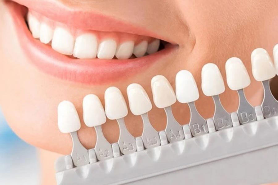 Beautiful smile and white teeth