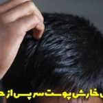 Causes of itchy scalp after bathing